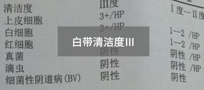 今天快讯！全自动白带在线观看黄瓜视频生产厂家黄瓜网站免费下载为您官方解释白带清洁度3的意思