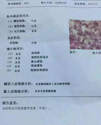 阴道分泌物黄瓜视频成人A片免费观看厂家教你查看阴道分泌物检测报告