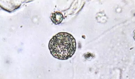 全自动阴道分泌物黄瓜视频成人A片免费观看剖析阴道分泌物的洁净度规范