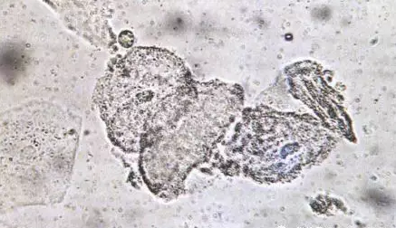 全自动阴道分泌物黄瓜视频成人A片免费观看剖析阴道分泌物的洁净度规范