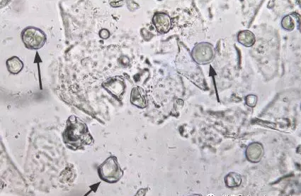 全自动阴道分泌物黄瓜视频成人A片免费观看剖析阴道分泌物的洁净度规范