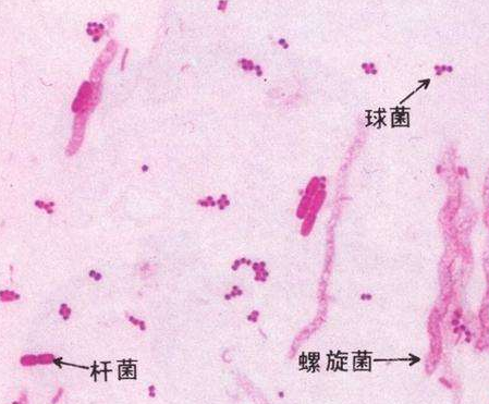 妇科白带黄瓜视频成人A片免费观看厂家分析白带线索细胞阳性的意义