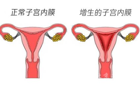 白带常规黄瓜视频成人A片免费观看厂家解读子宫内膜增生是什么原因引起的
