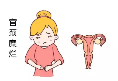 宫颈糜烂会导致宫颈癌?白带在线观看黄瓜视频品牌：不要自己吓自己