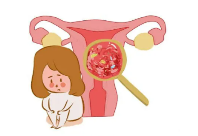 阴道分泌物黄瓜视频成人A片免费观看厂家总结病理性的白带异常有哪些