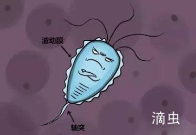 白带黄瓜视频成人A片免费观看品牌介绍滴虫性阴道炎的早期症状以及预防方法
