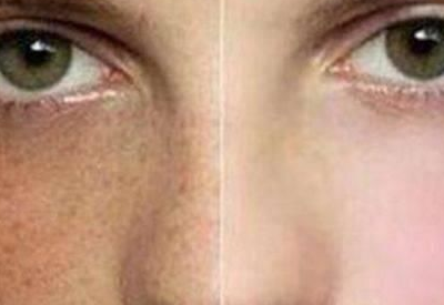 阴道分泌物黄瓜视频成人A片免费观看品牌分析为什么患妇科病的女性脸上更容易长斑