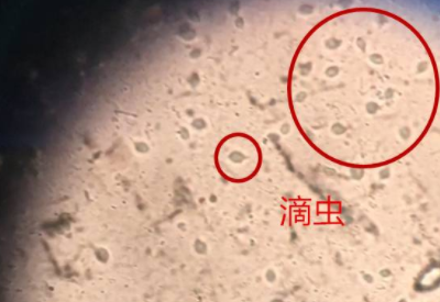 白带在线观看黄瓜视频品牌科普滴虫性阴道炎是因为体内长了虫子吗