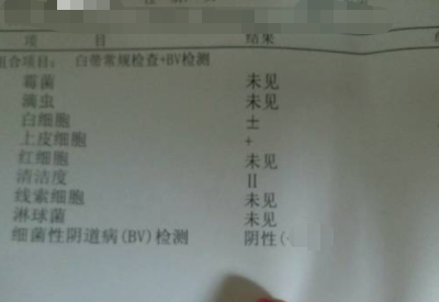 全自动白带在线观看黄瓜视频分享如何看懂白带常规检测报告单
